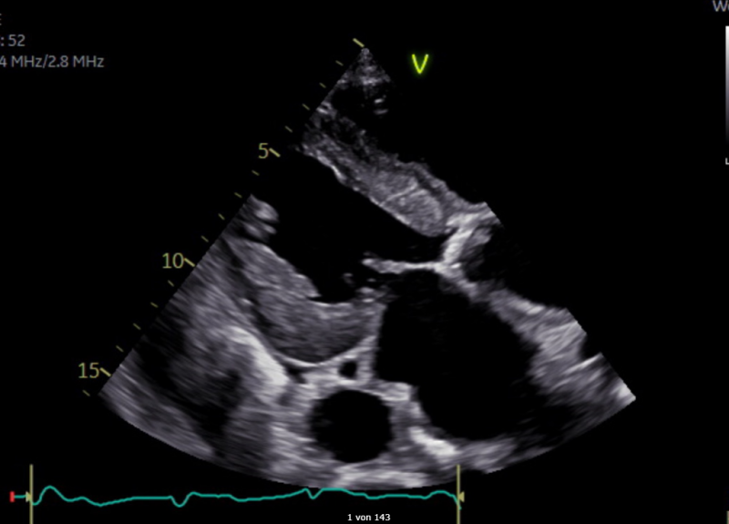 Grundkurs Echokardiographie